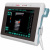 Esaote MyLab One Touch