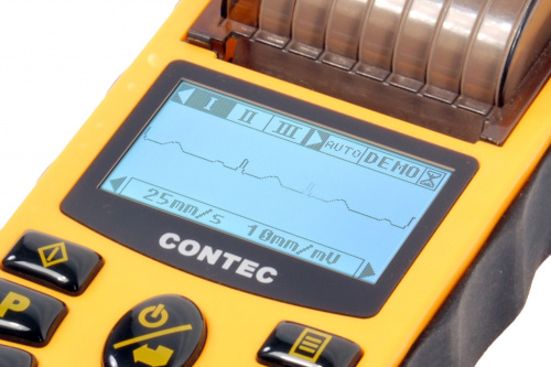 Contec ECG80A