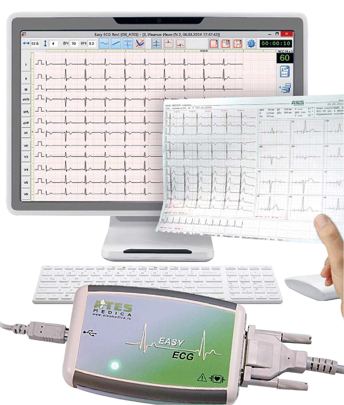 Ates Medica Device Easy ECG